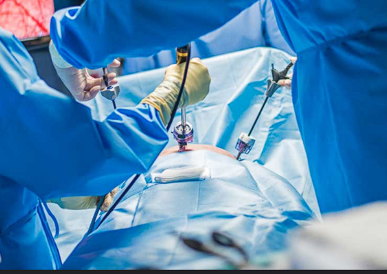 cura laparoscopiuca herniue abdominala