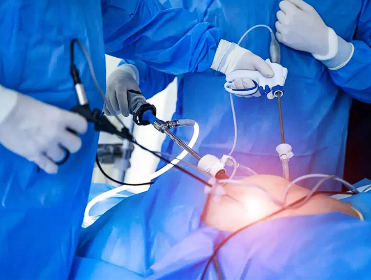 Adrenalectomie Laparoscopică