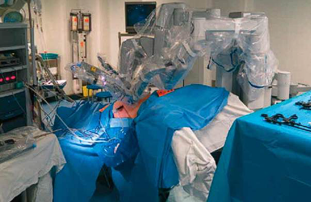 Splenectomie Robotică