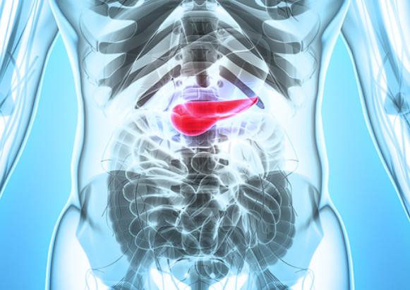 Tumora de Pancreas