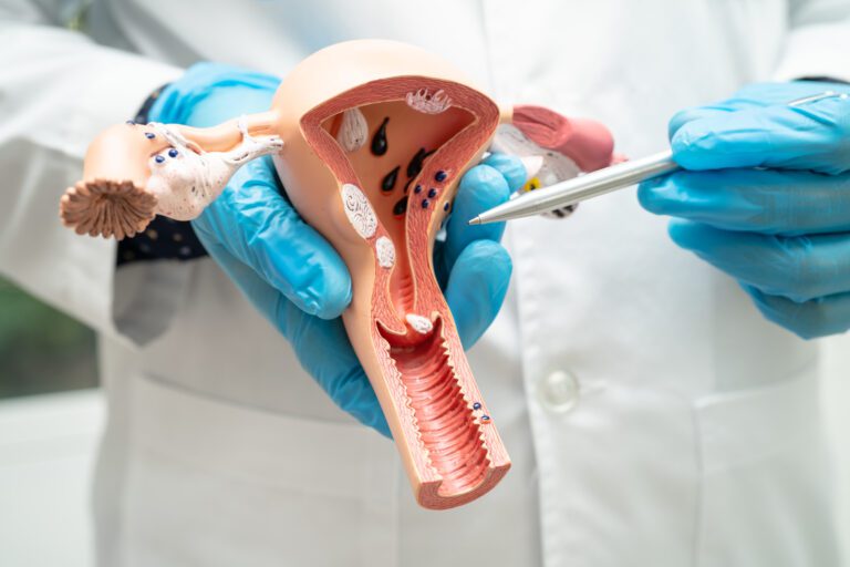 Uterus, doctor holding anatomy model for study diagnosis and tre