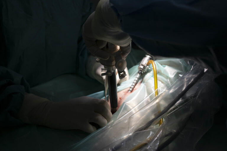 Closeup shot of hands with surgical instruments during a surgical process on the dark background