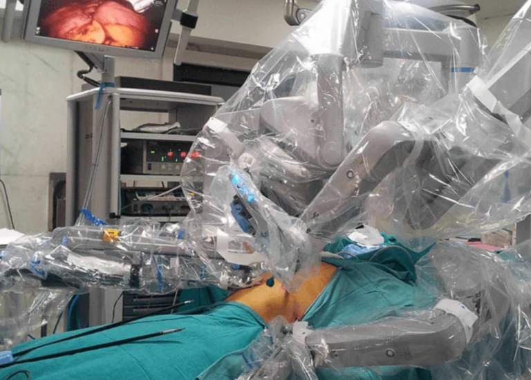 fundoplicatura nissen robotica
