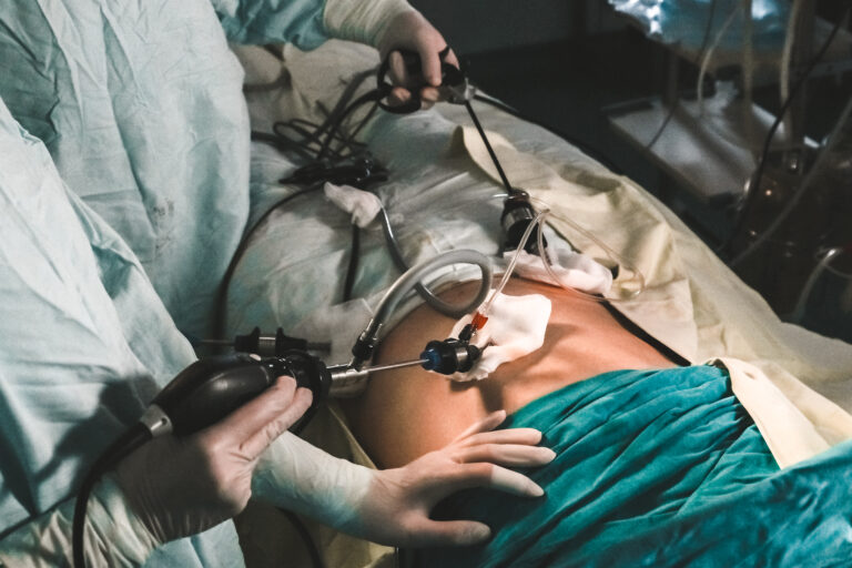 Laparoscopic Heller operation