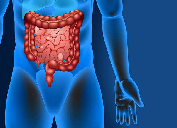 obstructie intestinala