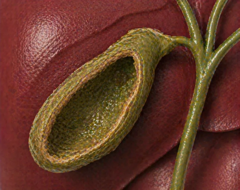 Ilustratie medicala colecist scleroatrofic cu perete ingrosat si contractat fara elemente grafice suplimentare