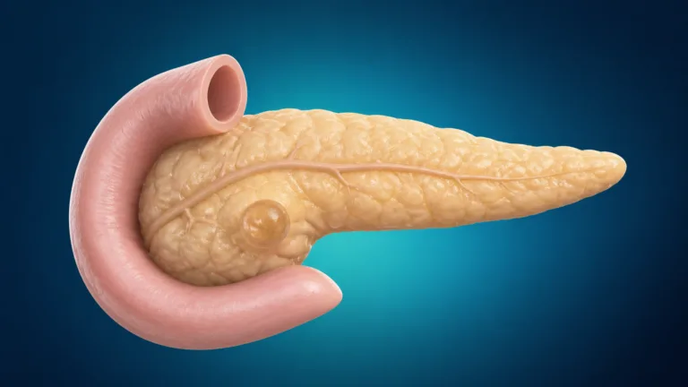 Ilustrație medicală pancreas și chist pancreatic