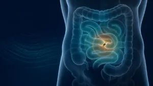 Ilustrație medicală pentru ocluzie intestinală