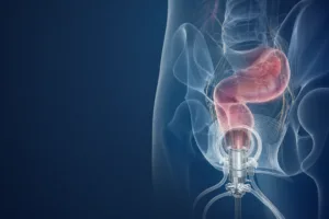 Chirurgie laparoscopică transanală (TaTME / TAMIS)