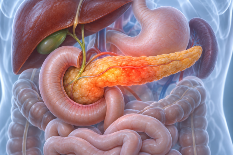 Pancreatita acută: cauze, simptome și semnele care impun internare